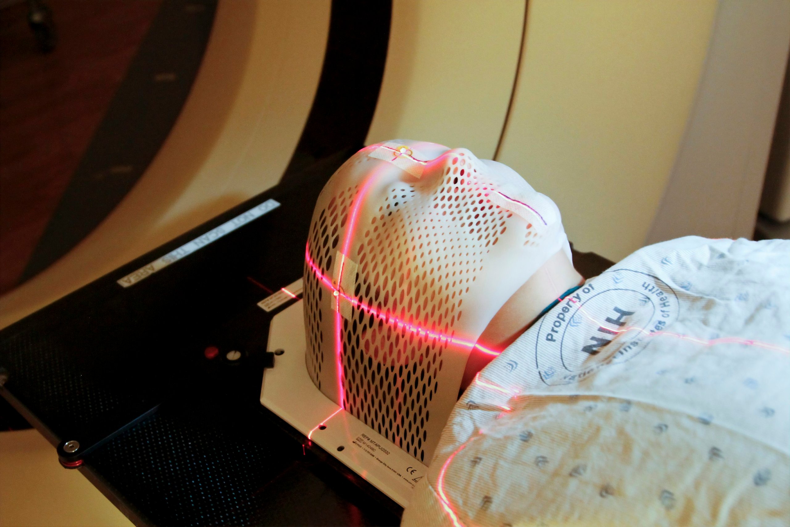 Accuray and RaySearch extend adaptive radiotherapy integration Accuray and RaySearch extend adaptive radiotherapy integration